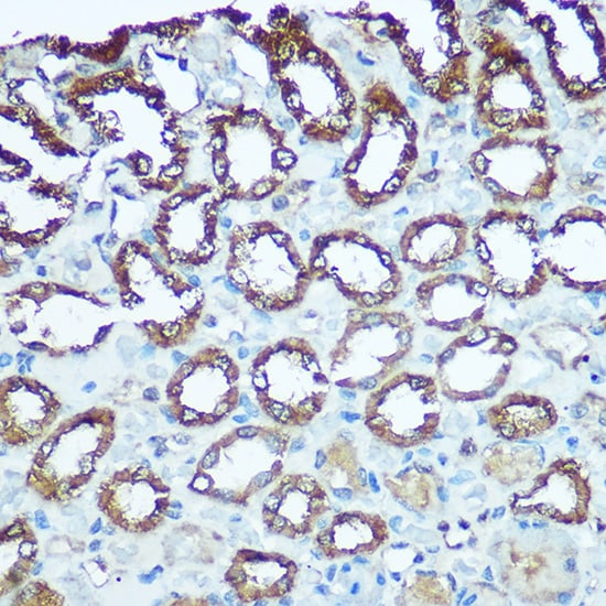 UQCRFS1 Antibody