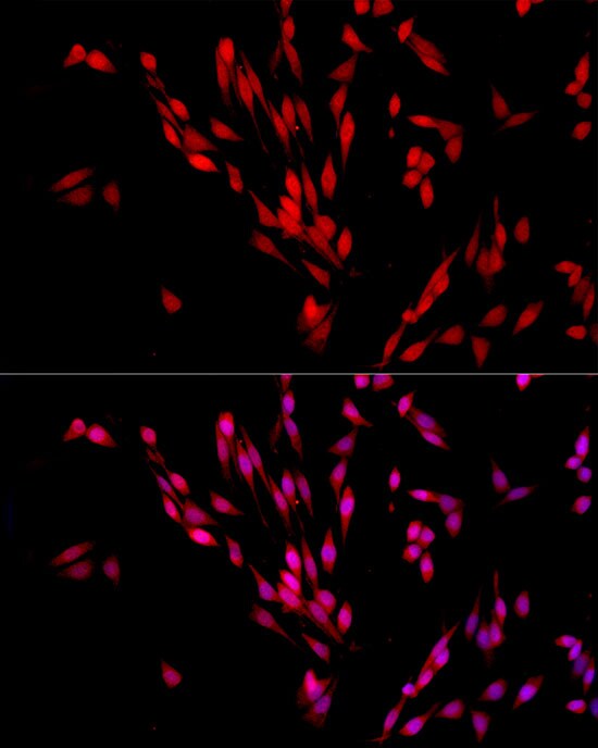 Exportin-5 Antibody