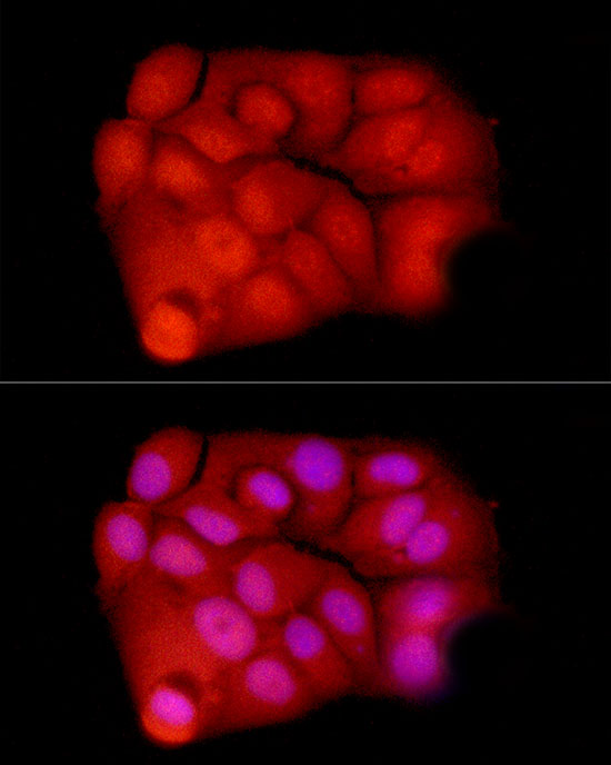 Exportin-5 Antibody