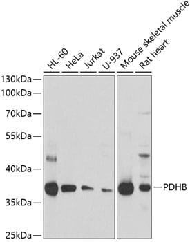 Pyruvate Dehydrogenase E1 beta subunit Antibody
