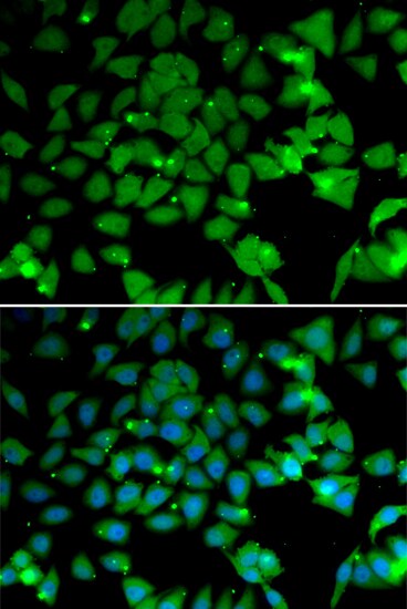 NAA10 Antibody