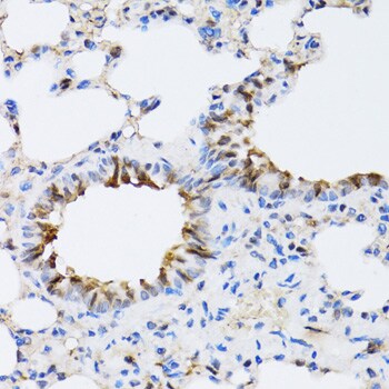 NAA10 Antibody