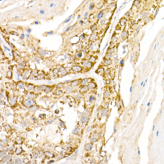 AP3B1 Antibody