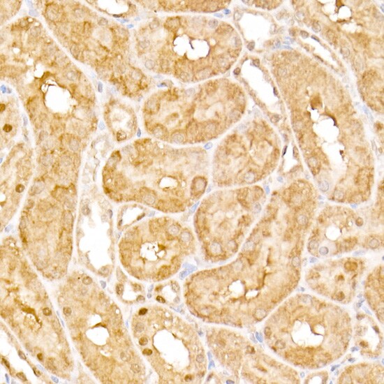 AP3B1 Antibody