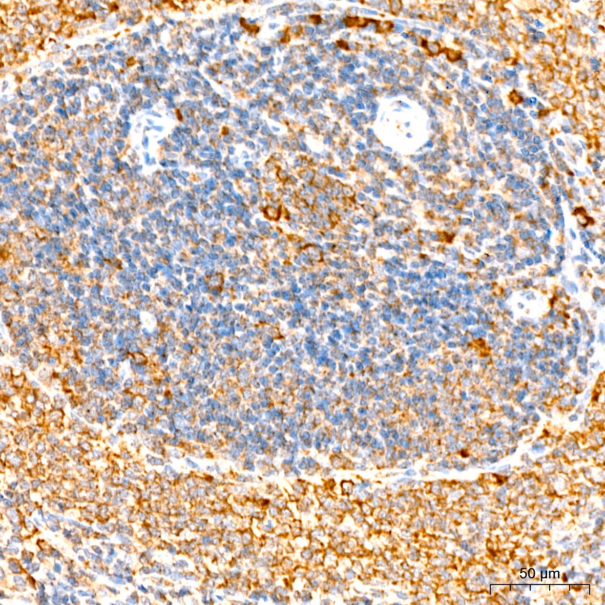 EIF3F Antibody