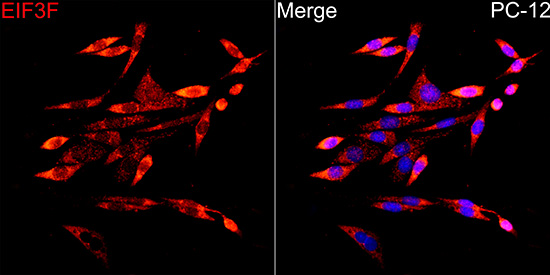 EIF3F Antibody
