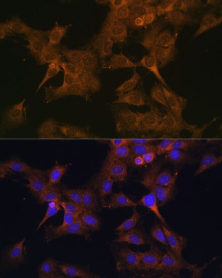 EIF2B2 Antibody