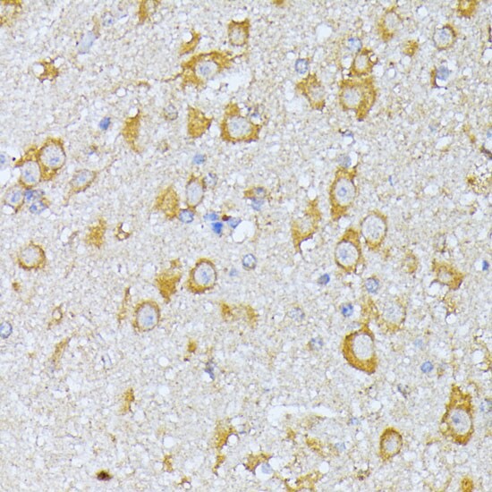 EIF2B2 Antibody