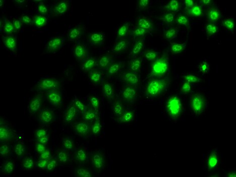 MTGR1 Antibody