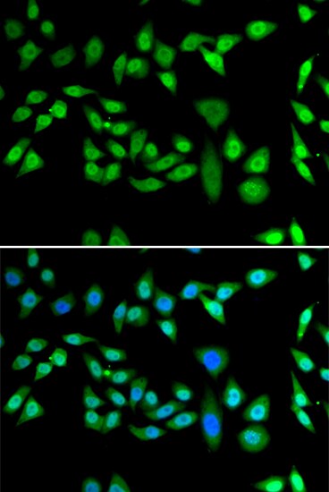 DNAJB6 Antibody