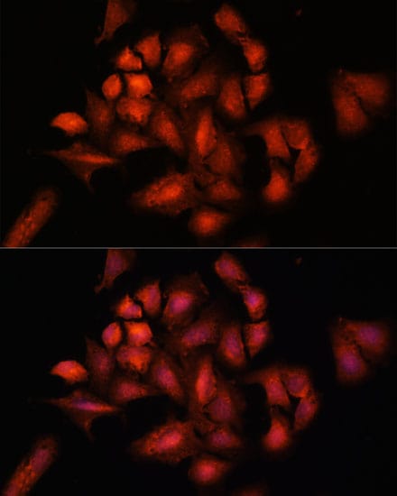 STAM2 Antibody