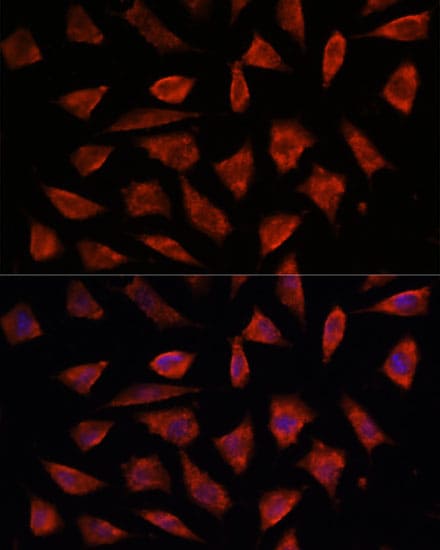 STAM2 Antibody