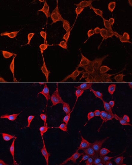 DNAJA2 Antibody