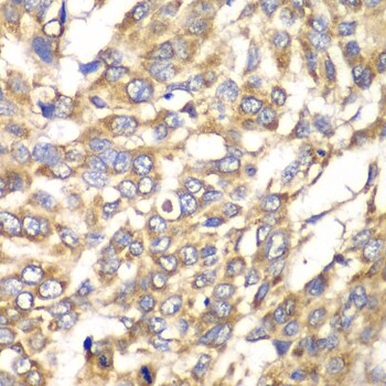 VTI1B Antibody