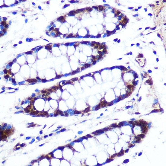 APIP Antibody