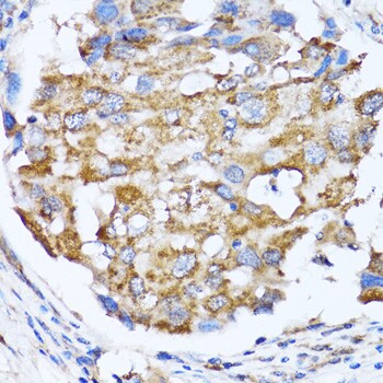 NDE1 Antibody