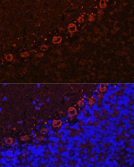 Als2 Antibody