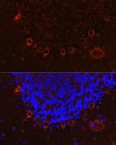 Als2 Antibody