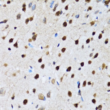 DBC1/p30 Antibody