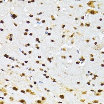 DBC1/p30 Antibody