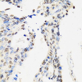 DBC1/p30 Antibody