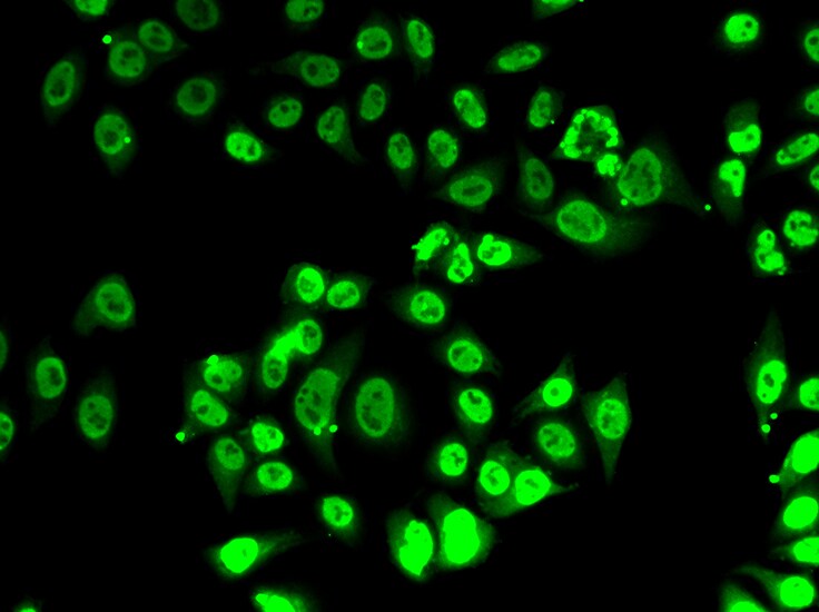FIP1L1 Antibody