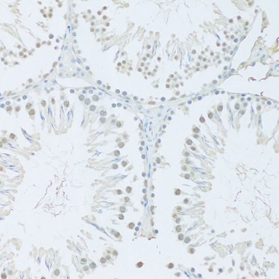 FIP1L1 Antibody