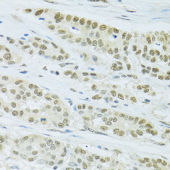 FIP1L1 Antibody
