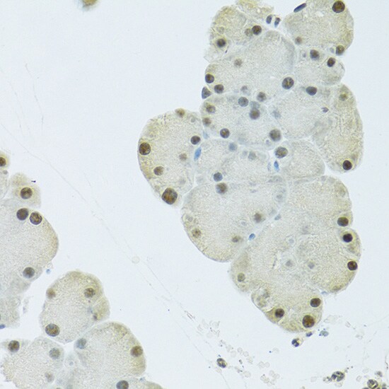 FIP1L1 Antibody