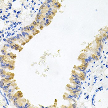 ALKBH8 Antibody