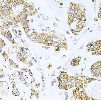ALKBH8 Antibody