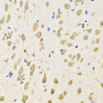 PTP epsilon Antibody