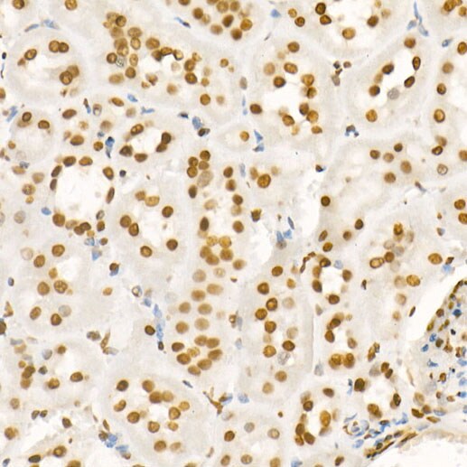 H4 Clustered Histone 1 [ac Lys8] Antibody
