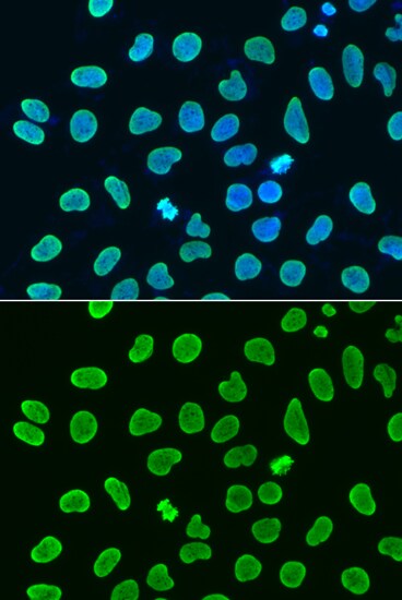H4 Clustered Histone 1 [ac Lys8] Antibody