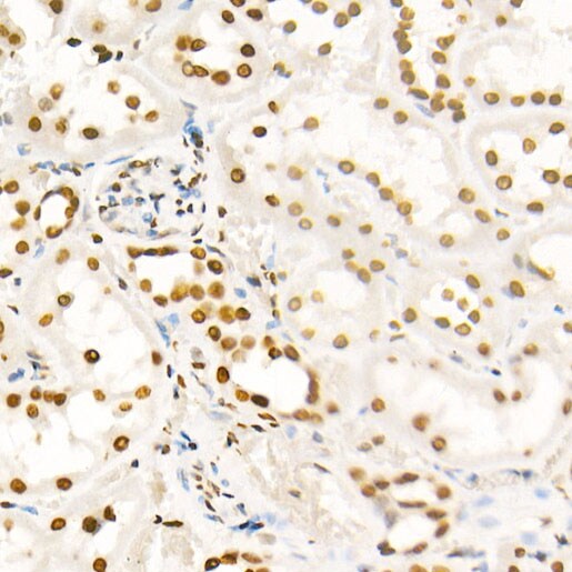 H4 Clustered Histone 1 [ac Lys8] Antibody