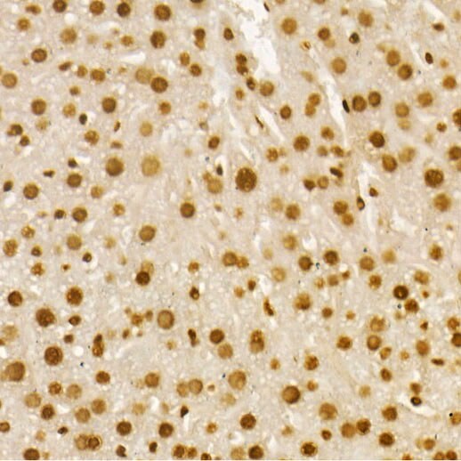 H4 Clustered Histone 1 [ac Lys8] Antibody