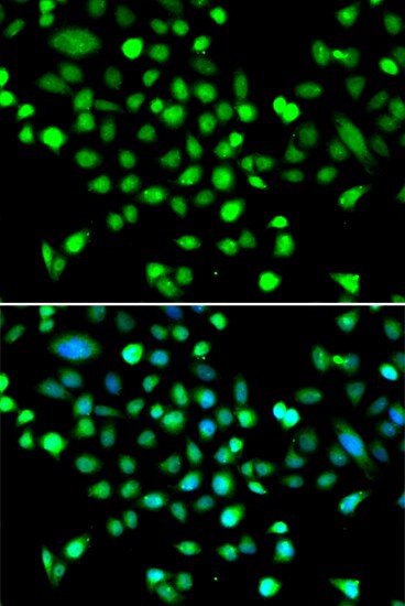 AMPK gamma 1 Antibody