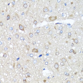 AMPK gamma 1 Antibody