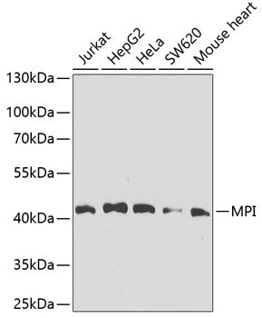 Mannose Phosphate Isomerase Antibody