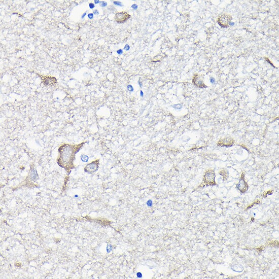 EEF1A2 Antibody