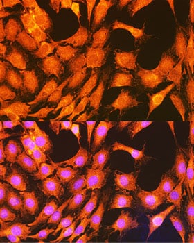 PHKG2 Antibody