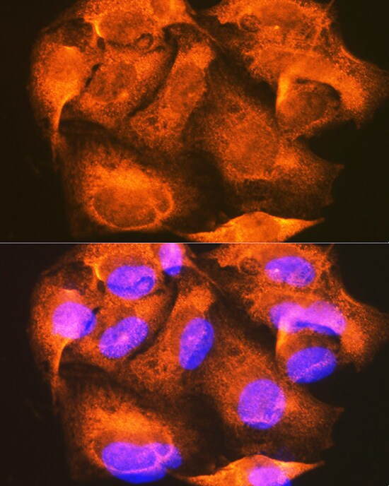 PHKG2 Antibody