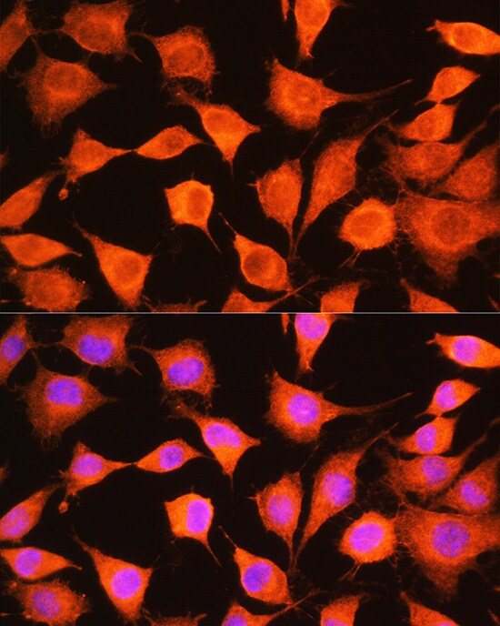 PHKG2 Antibody