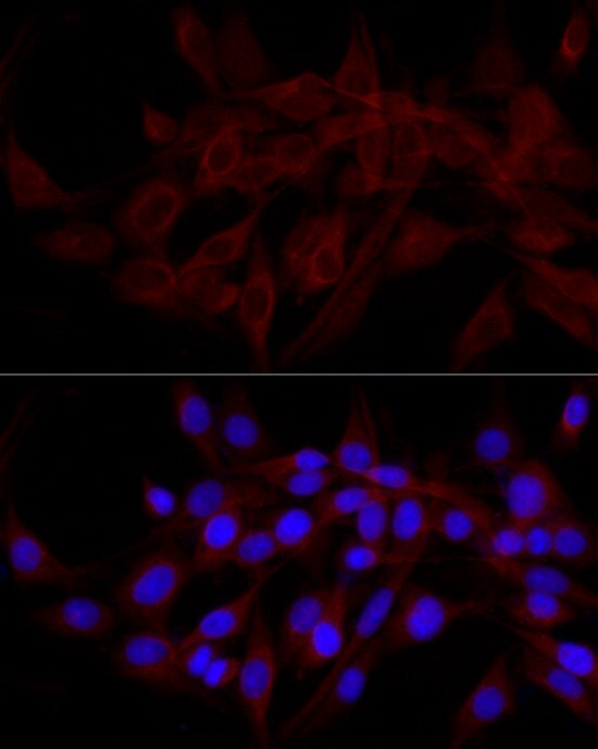 NDP52 Antibody