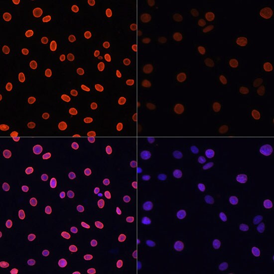 H4 Clustered Histone 1 [ac Lys91] Antibody