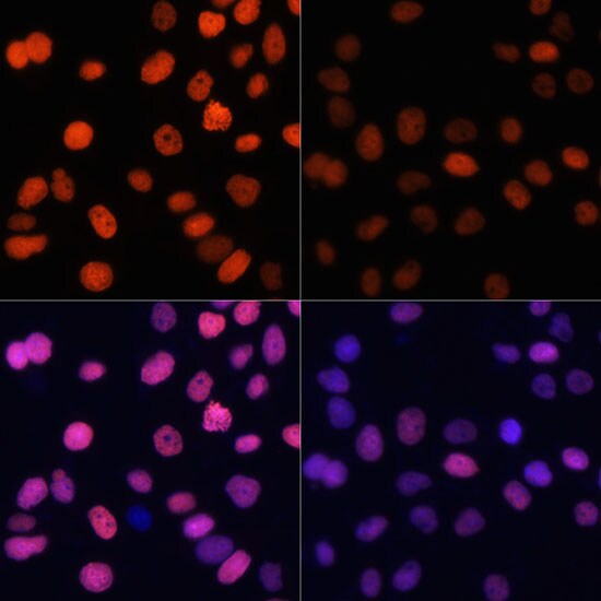 H4 Clustered Histone 1 [ac Lys91] Antibody