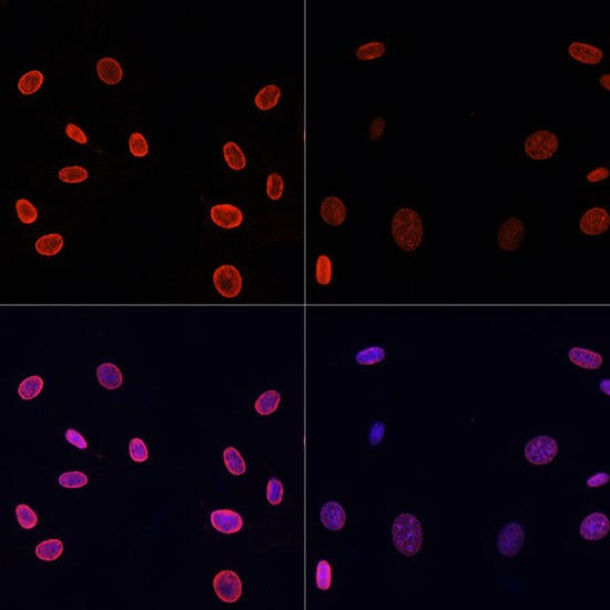 H4 Clustered Histone 1 [ac Lys91] Antibody