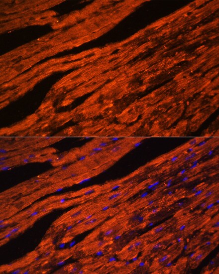 LDB3 Antibody