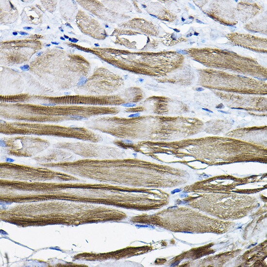 LDB3 Antibody