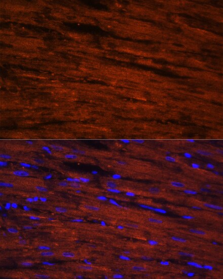 LDB3 Antibody